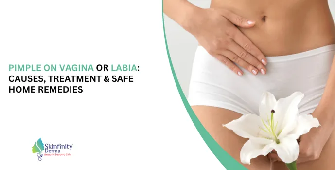 Pimple on Vagina or Labia
