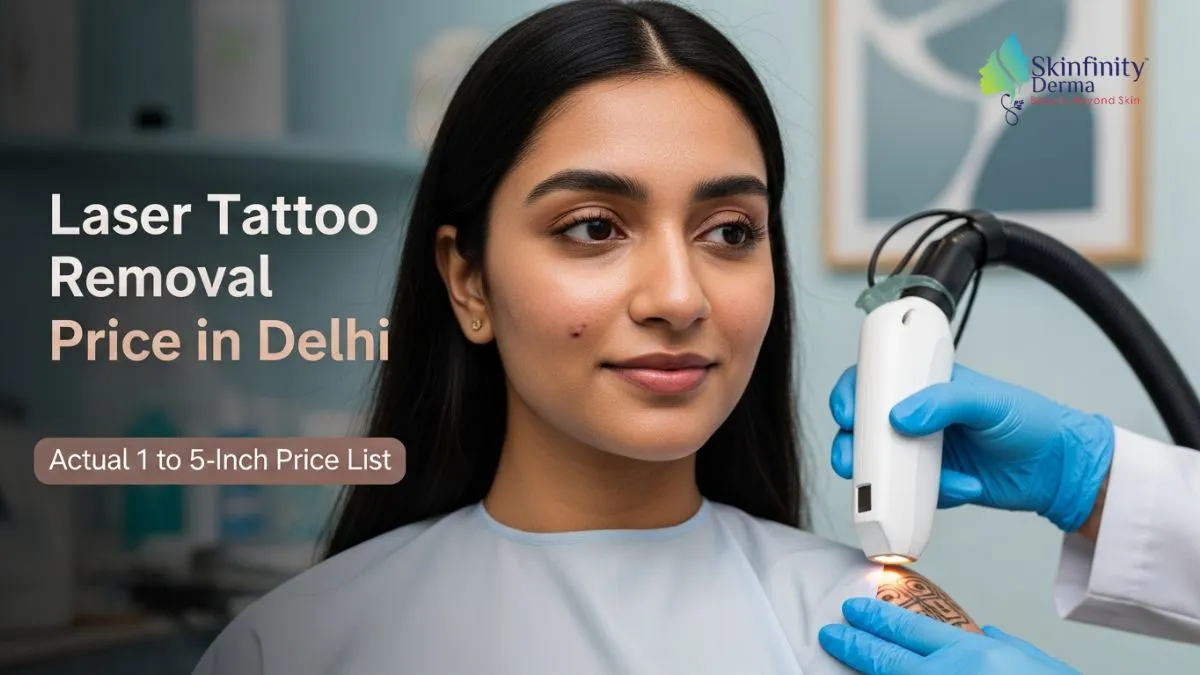 Laser Tattoo Removal Price in Delhi